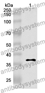 Anti-Human MYOM1 Polyclonal Antibody