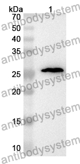 Anti-Human HNRNPM Polyclonal Antibody