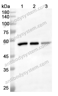 Anti-KPNA2 Polyclonal Antibody