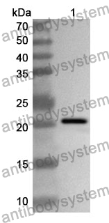 Anti-JAK3 Polyclonal Antibody