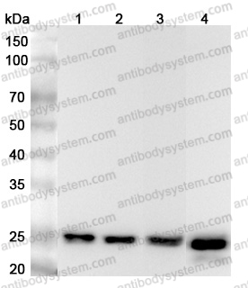 Anti-Human ARHGDIA Polyclonal Antibody