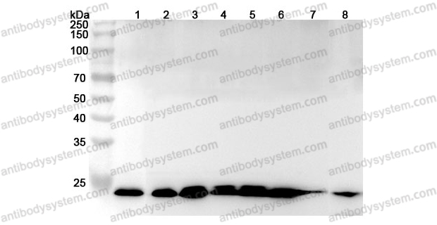 Anti-ARHGDIB Polyclonal Antibody