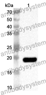 Anti-Human AGFG1 Polyclonal Antibody