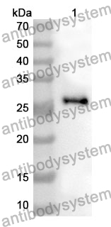 Anti-STAT2 Polyclonal Antibody