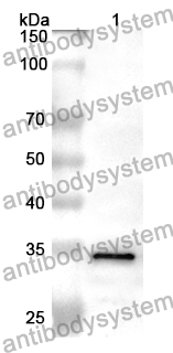 Anti-MSH6 Polyclonal Antibody