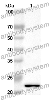 Anti-Human ZNF143 Polyclonal Antibody