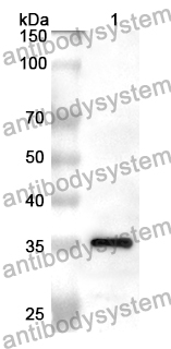 Anti-HK2 Polyclonal Antibody