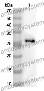 Anti-HK3 Polyclonal Antibody