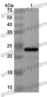 Anti-EFNB2 Polyclonal Antibody