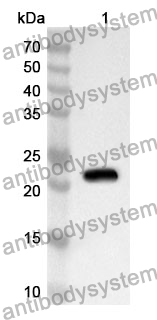 Anti-EFNA5 Polyclonal Antibody