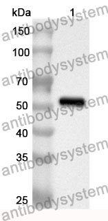 Anti-STC1 Polyclonal Antibody