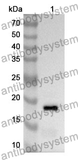 Anti-THOP1 Polyclonal Antibody