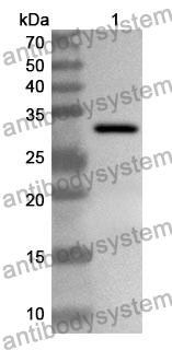 Anti-CAPZA1 Polyclonal Antibody