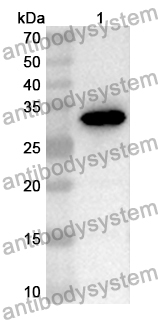 Anti-NUP98 Polyclonal Antibody