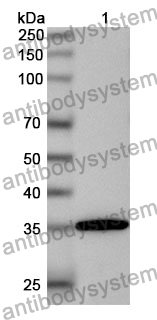 Anti-Human NKX2-5 Polyclonal Antibody