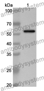 Anti-Human PPP5C Polyclonal Antibody