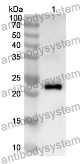 Anti-PLK1 Polyclonal Antibody