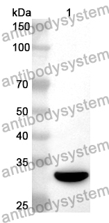 Anti-Human NUDT6 Polyclonal Antibody