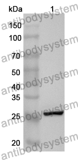 Anti-Human COL4A4 Polyclonal Antibody