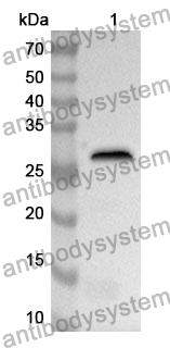 Anti-Human CTSC Polyclonal Antibody