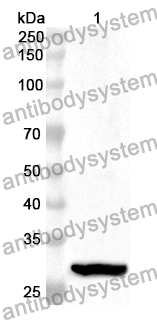 Anti-Human LIMK1 Polyclonal Antibody