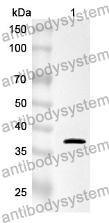 Anti-Human LIMK2 Polyclonal Antibody