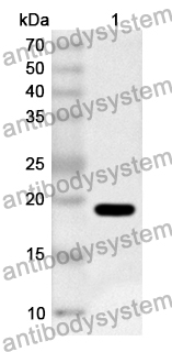 Anti-AP2S1 Polyclonal Antibody