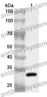 Anti-HCCS Polyclonal Antibody