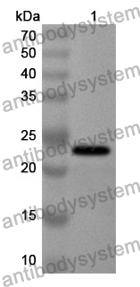 Anti-RCAN1 Polyclonal Antibody