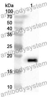 Anti-RARS1 Polyclonal Antibody