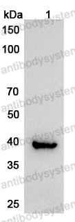 Anti-Human ATXN3 Polyclonal Antibody