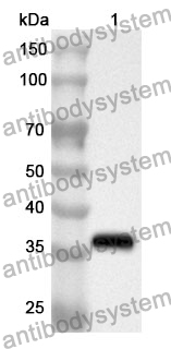 Anti-ATN1 Polyclonal Antibody