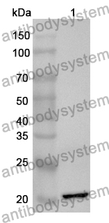 Anti-Human TERF1 Polyclonal Antibody