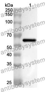 Anti-YARS1 Polyclonal Antibody