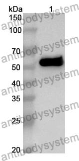 Anti-USP14 Polyclonal Antibody