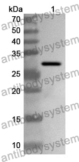 Anti-PRKAG1 Polyclonal Antibody