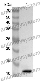 Anti-HSPA2 Polyclonal Antibody