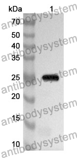 Anti-BCAT1 Polyclonal Antibody