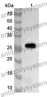 Anti-CD298/ATP1B3 Polyclonal Antibody