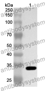 Anti-NAGLU Polyclonal Antibody