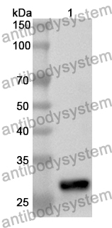 Anti-Human AK2 Polyclonal Antibody