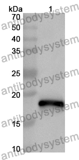 Anti-SLC12A3 Polyclonal Antibody