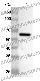 Anti-PSMD4 Polyclonal Antibody