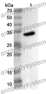 Anti-F2RL1 Polyclonal Antibody