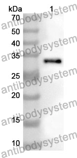 Anti-UCN Polyclonal Antibody