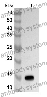 Anti-INHBC Polyclonal Antibody