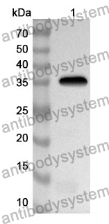 Anti-Human NAP1L1 Polyclonal Antibody