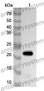 Anti-CASP7 Polyclonal Antibody