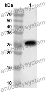 Anti-GP2 Polyclonal Antibody