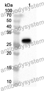 Anti-ADK Polyclonal Antibody